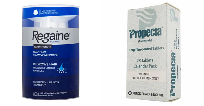 over the counter treatments for male pattern baldness